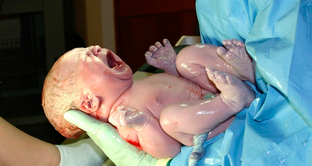 Гемангиома новорожденных - лечение существует!|Дети в городе